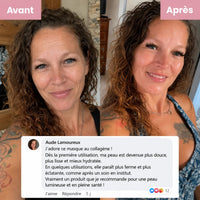 Masque de Nuit Kaela : avant/après et avis client