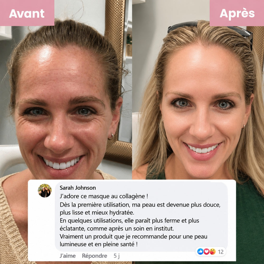 Masque de Nuit Kaela : avant/après et avis client
