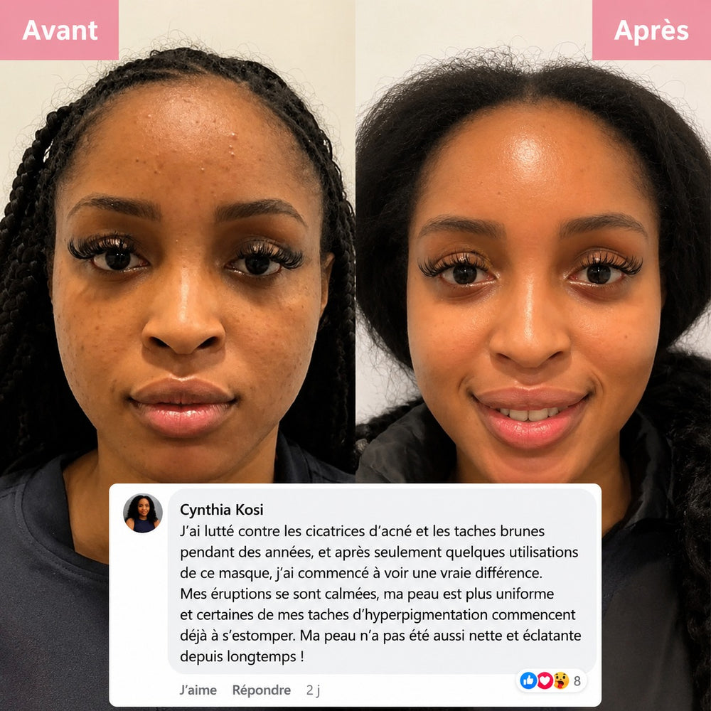 Masque de Nuit Kaela : avant/après sur peau à taches brunes