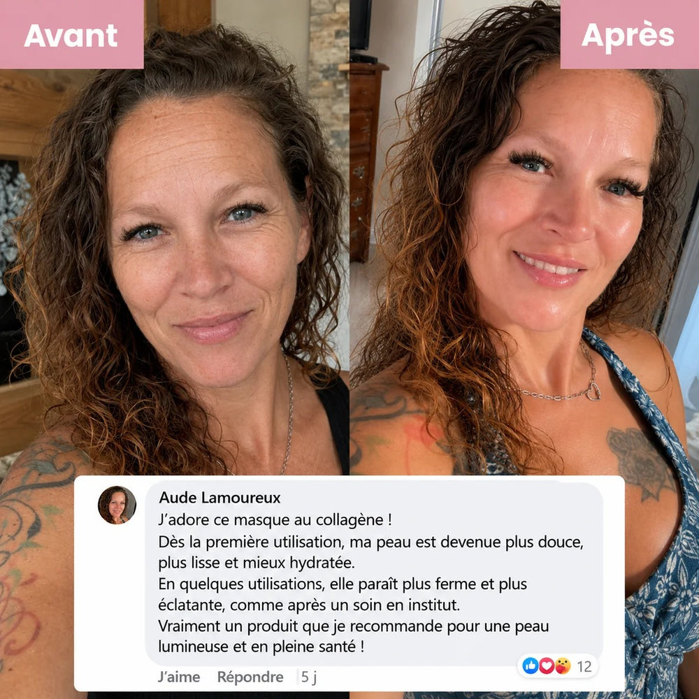 Masque de Nuit Kaela : avant/après et avis client