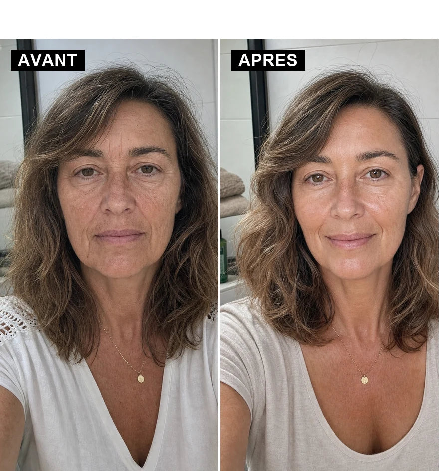 Avant / après de Ceylin C. après utilisation du masque de nuit